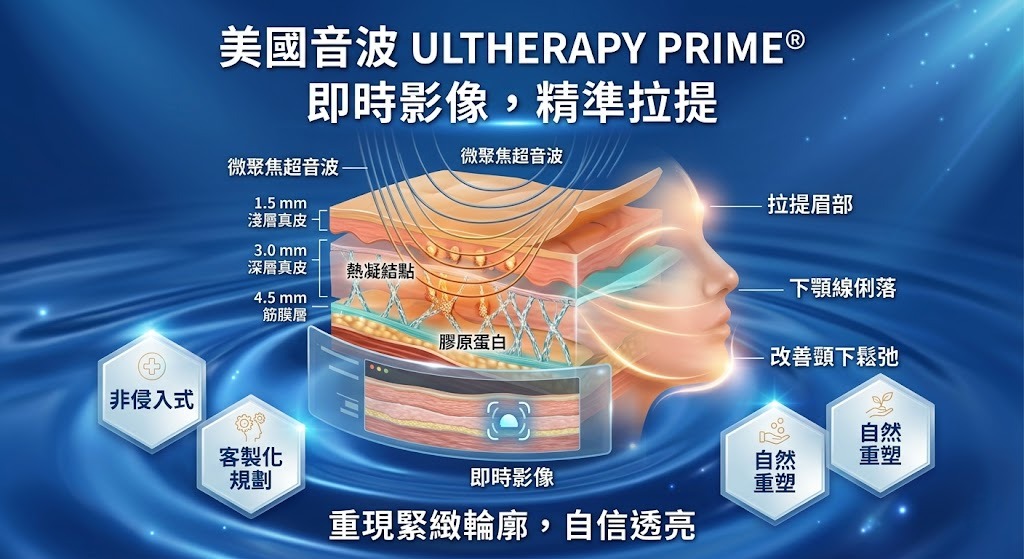 美國音波是什麼?Ultherapy PRIME 極透+原理、適合族群、療程流程與注意事項完整指南